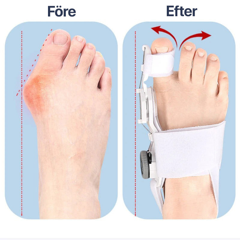 Tåkorrigerare for hallux valgus med justerbart støtte