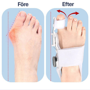 Tåkorrigerare for hallux valgus med justerbart støtte
