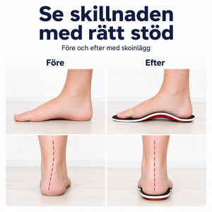 Skoinnlegg mot pronasjon og plattfot