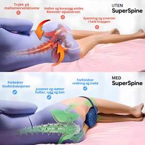 SuperSpine™