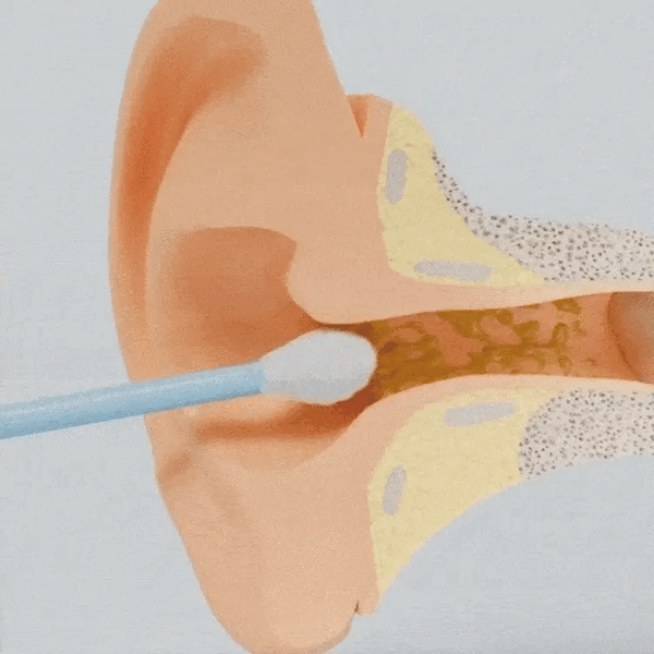 EarClean - Rengöring av öronvax